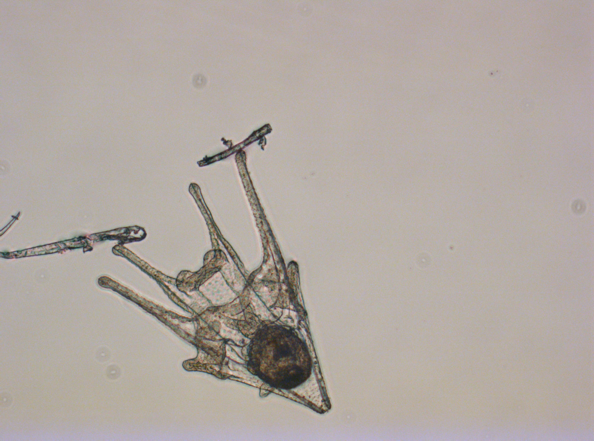 Optimising stocking density for the commercial cultivation of sea urchin larvae